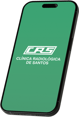 Celular com o logo da CRS